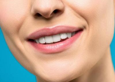 7 روش ساده برای داشتن دندان هایی سفید و زیبا